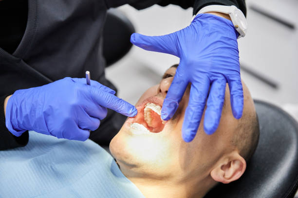 Best Emergency Dental Care for Broken or Chipped Teeth in Harb, OR